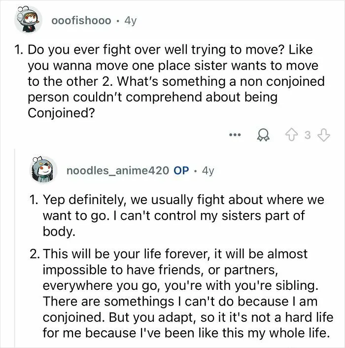 Conjoined Twins Answer 24 People’s Most Interesting And Burning Questions