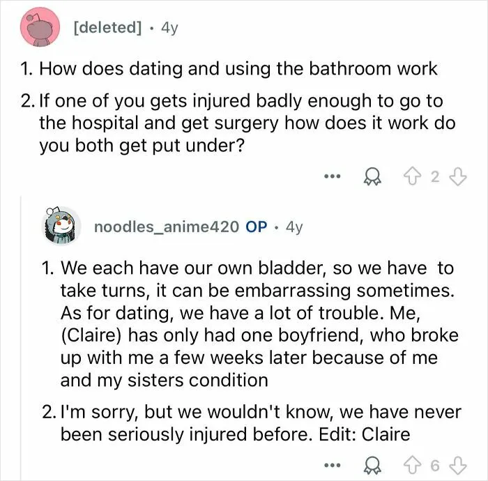 Conjoined Twins Answer 24 People’s Most Interesting And Burning Questions