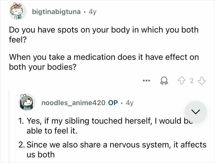 Conjoined Twins Answer 24 People’s Most Interesting And Burning Questions