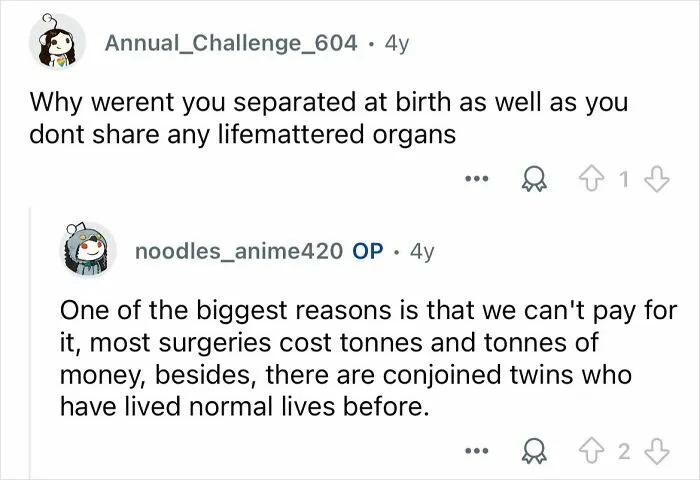 Conjoined Twins Answer 24 People’s Most Interesting And Burning Questions