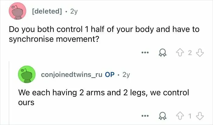 Conjoined Twins Answer 24 People’s Most Interesting And Burning Questions