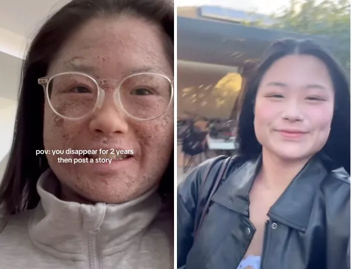 50 Glow-Ups People Are Proud Of And Wanted To Share