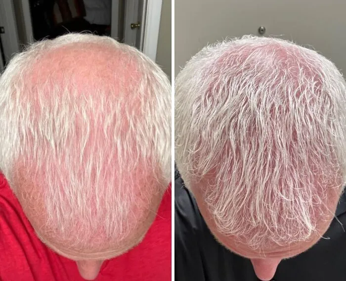 Everyone's Favorite Hair Growth Elixir Is Now In Shampoo Form, So Get Ready For Some Serious Rapunzel Vibes From <a Style="Display:inline;" Href="Https://Www.amazon.com/Biotin-Hair-Shampoo-Thinning-Moisturizing/Dp/B01encboa0?ie=utf8&th=1&linkcode=ll1&tag=bpemu-20&linkid=30306417eb20fdfdefe5f7c536014721&language=en_us&ref_=as_li_ss_tl" Target="_blank">  <span Style="Font: Inherit; Color: #d74b1f;"> Rosemary And Biotin Shampoo</Span>