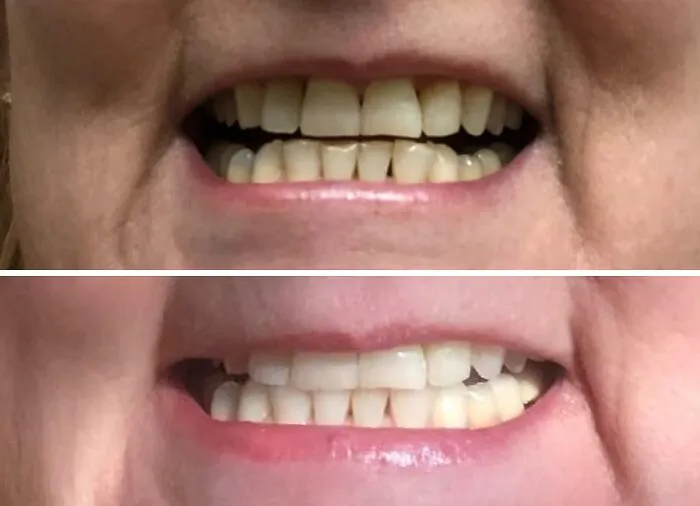 That Daily Coffee Habit Doesn't Have To Show On Your Teeth When You've Got A Trusty <a Style="Display:inline;" Href="Https://Www.amazon.com/Venus-Visage-Effective%ef%bc%86painless-Sensitivity-Travel-Friendly/Dp/B082x2gsgj?ie=utf8&linkcode=ll1&tag=bpemu-20&linkid=1fd6085bc534899c53d28e837e93439d&language=en_us&ref_=as_li_ss_tl" Target="_blank">  <span Style="Font: Inherit; Color: #d74b1f;"> Teeth Whitening Pen</Span> On Hand