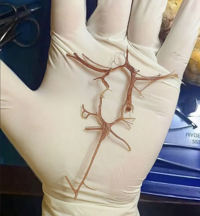 Este es el polígono de Willis, un anillo arterial vital en la base del cerebro.