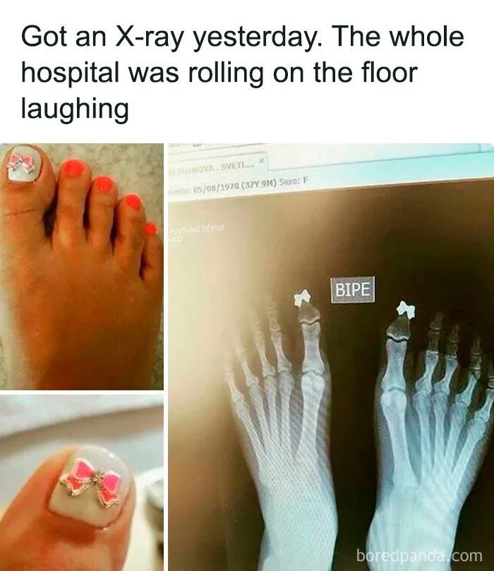 Foot with decorated toenails next to an X-ray showing bows on toes, a humorous medical meme about healthcare costs.