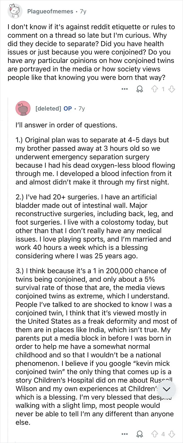Conjoined Twins Answer 24 People’s Most Interesting And Burning Questions