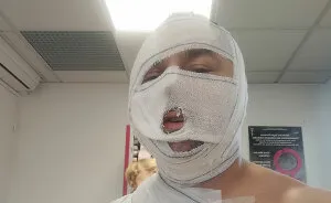 Man Wins Landmark Domestic Violence Case Against Ex-Girlfriend Who Scalded And Hospitalized Him