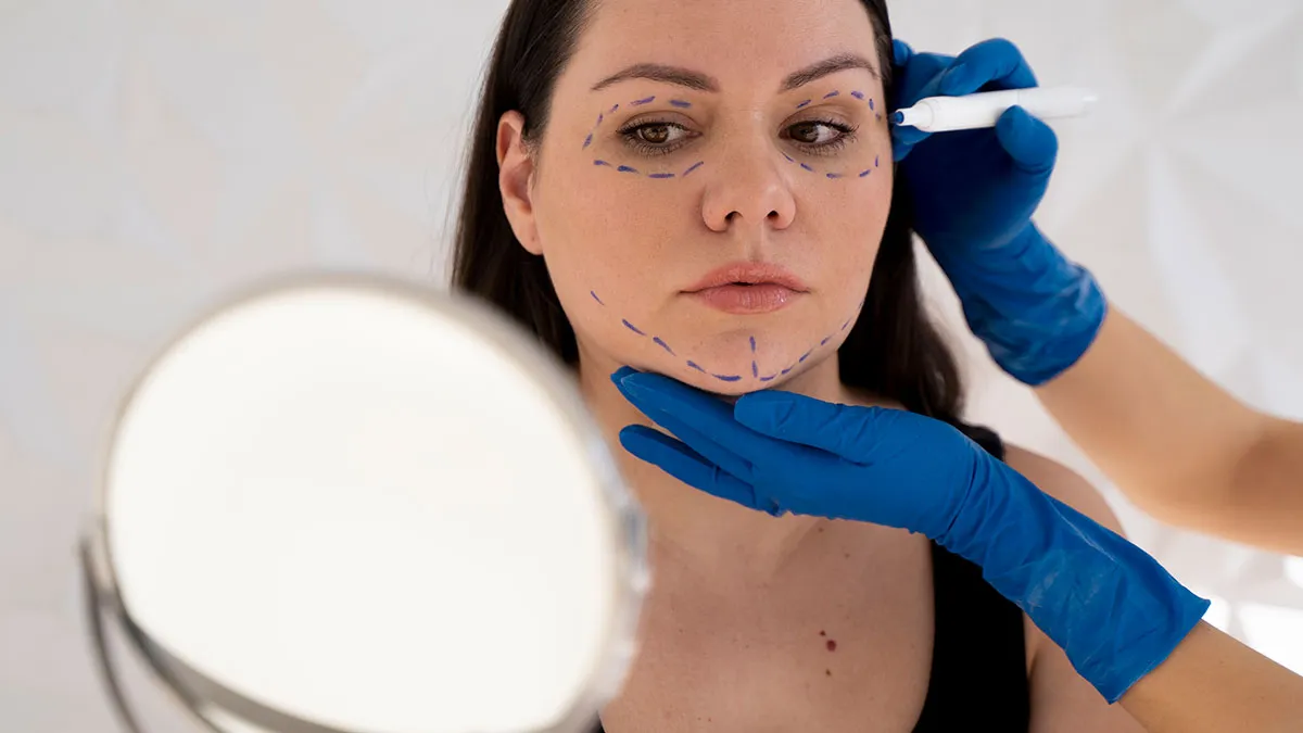 “I’m Honestly Terrified”: 28YO Gets A Facelift, People Are Questioning Reality