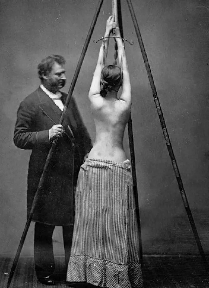 Lewis Sayre’s Suspension Device