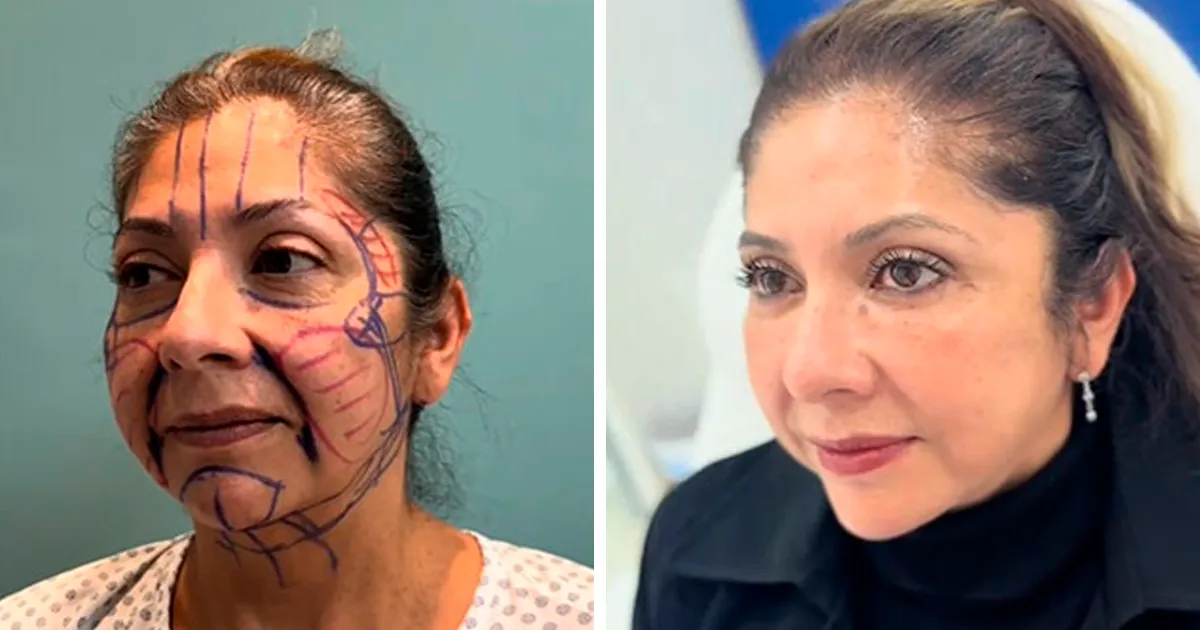 27 Personas que no se arrepienten en absoluto de su cirugía plástica