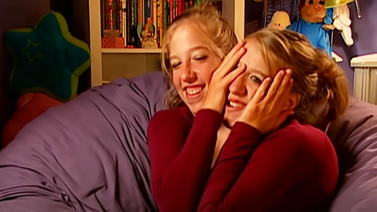 Conjoined Twins Answer 24 People’s Most Interesting And Burning Questions