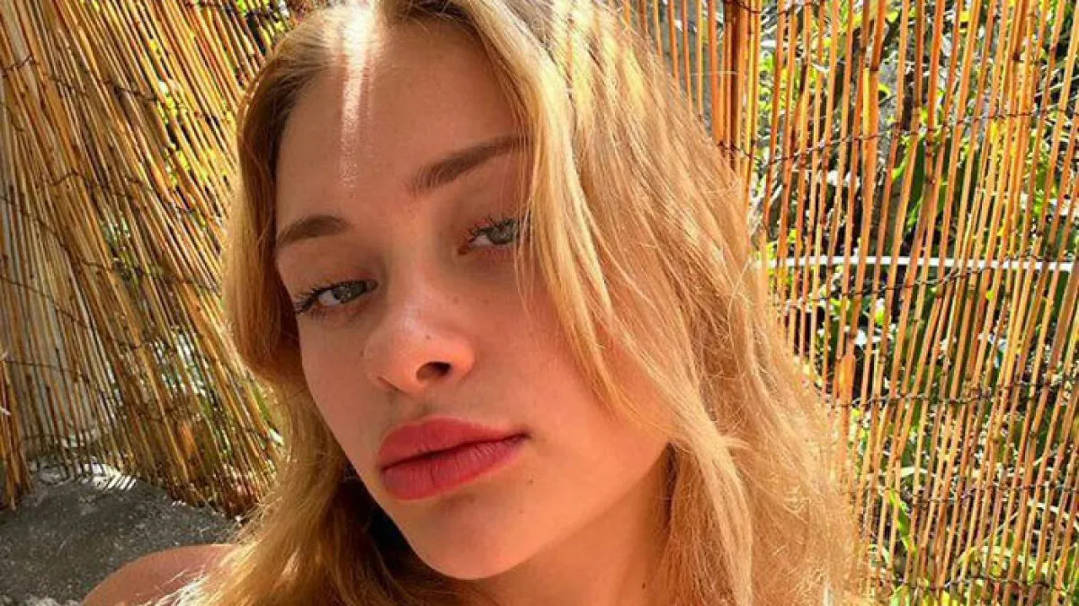Model Found With Broken Limbs And Spine On Dubai Roadside Was Treated Like A “Pet” By Wealthy Men
