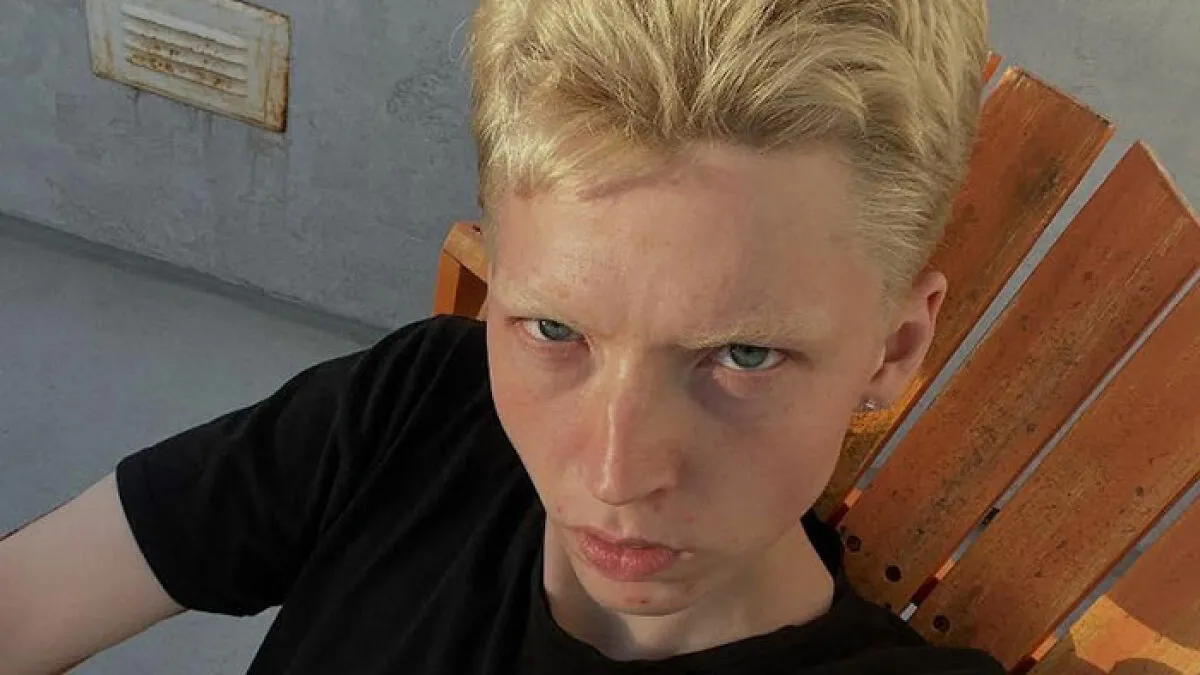 "You Should Be Allowed To Be Yourself": Trans Model Detransitions After 10 Years