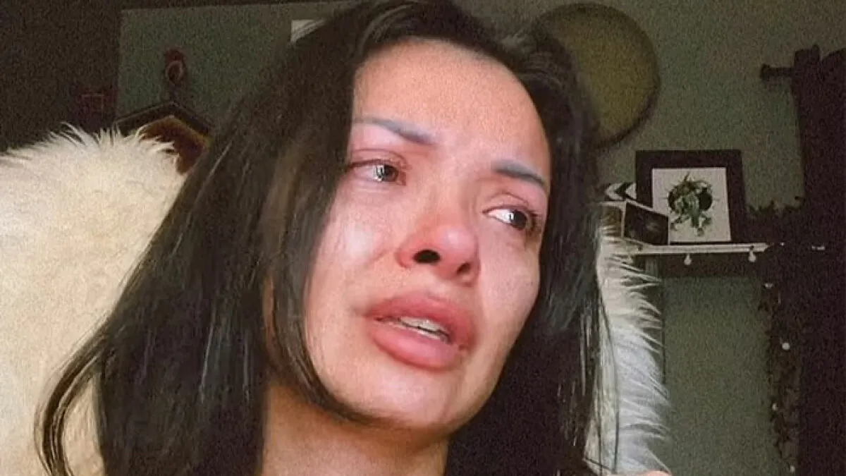 "Vanity Is Destroying So Many Lives": Woman Claims Her $6,640 Nose Job 'Ruined' Her Face