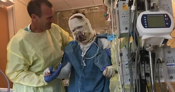 Woman Burned In Gas Station Explosion Stuns The Internet With Transformation 6 Years Later