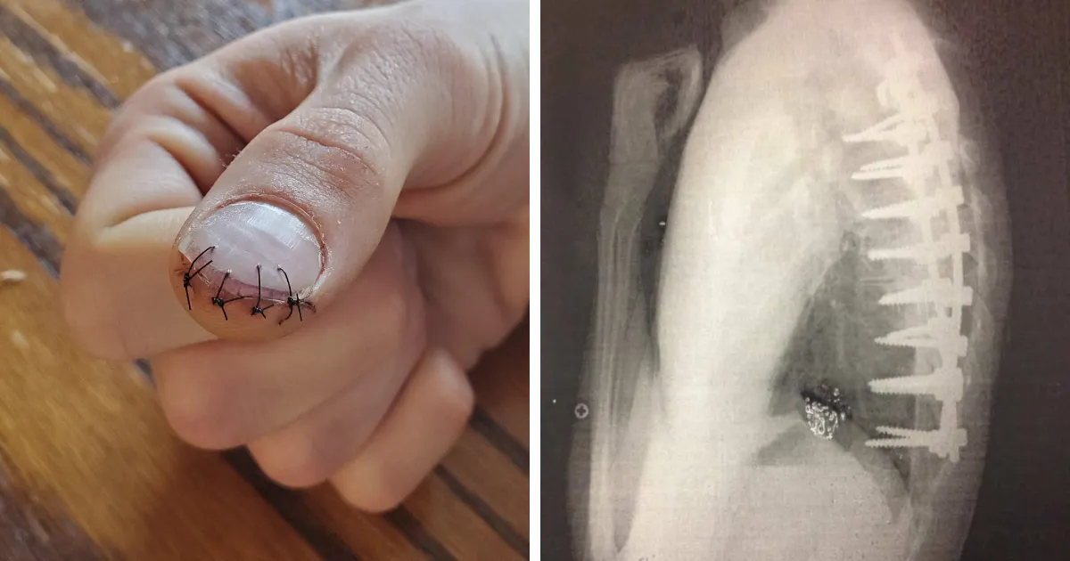 35 Fotos médicas que demuestran que el cuerpo es a veces aterrador