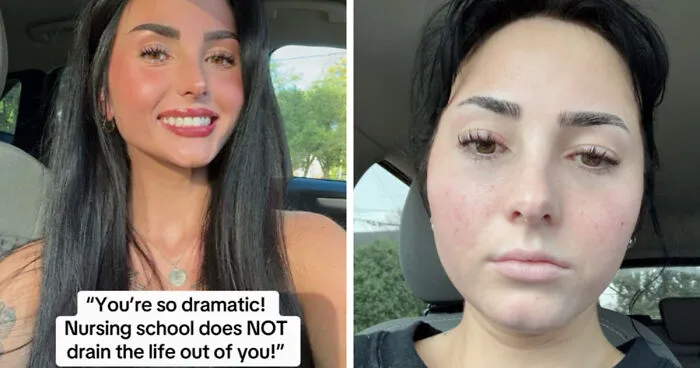 Folks Share 25 Pics Of Before And After “Life Happened” To Them