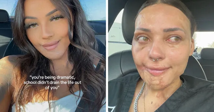 Folks Share 25 Pics Of Before And After “Life Happened” To Them