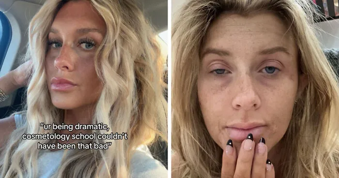 Folks Share 25 Pics Of Before And After “Life Happened” To Them