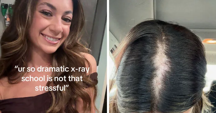 Folks Share 25 Pics Of Before And After “Life Happened” To Them