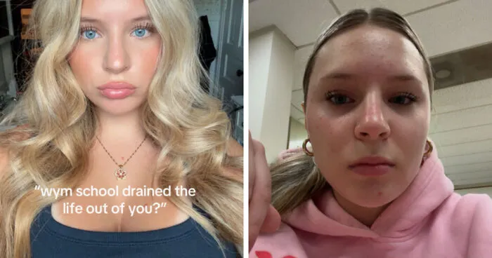Folks Share 25 Pics Of Before And After “Life Happened” To Them