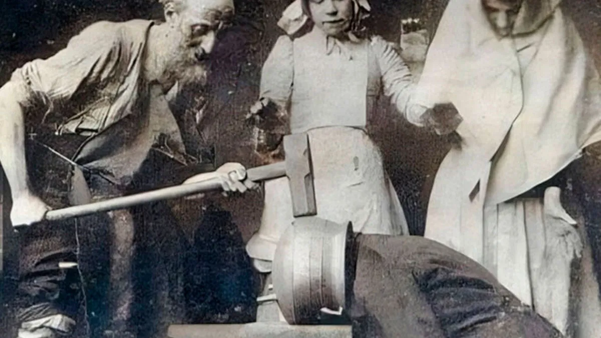 29 Strange, Old Medical Pics That Could Make Even Medical Students Say “Nope”