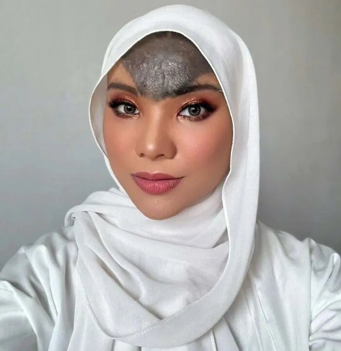 She Was Born With A Unique Birthmark On Her Forehead