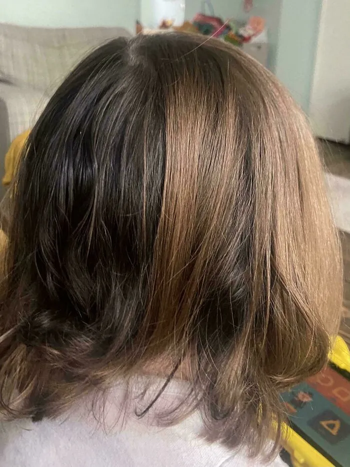 Mi hija nació con dos colores de pelo diferentes