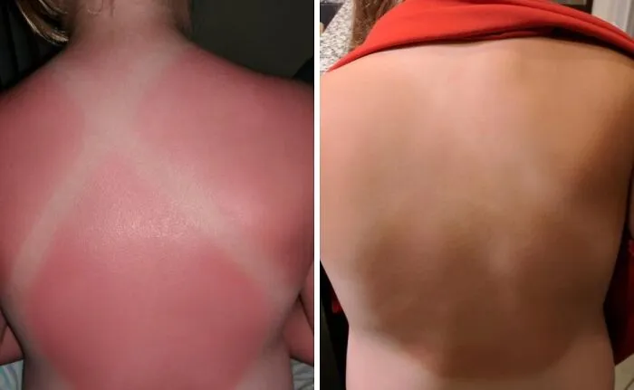 Give Your Sun-Kissed Skin Some Much-Needed Hydration And Calm After A Day In The Heat With Soothing <a Style="Display:inline;" Href="Https://Www.amazon.com/Burts-Bees-Coconut-Soother-Sunburn/Dp/B0013l55u0?ie=utf8&th=1&linkcode=ll1&tag=bpsquid-20&linkid=17897a247936323b295fe1df92e29c69&language=en_us&ref_=as_li_ss_tl" Target="_blank">  <span Style="Font: Inherit; Color: #d74b1f;"> Burt's Bees After Sun Lotion</Span>
