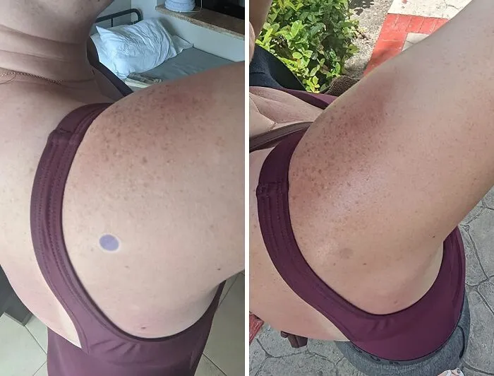 Never Again Will You Wonder If Your Sunscreen Is Still Doing Its Job Thanks To These Genius Little <a Style="Display:inline;" Href="Https://Www.amazon.com/Spotmyuv-Stickers-Sunscreen-Dermatrue-Technology/Dp/B08x6w1tzj?ie=utf8&th=1&linkcode=ll1&tag=bpsquid-20&linkid=8d1bbf211cced17e64f0b3b2325bcea1&language=en_us&ref_=as_li_ss_tl" Target="_blank">  <span Style="Font: Inherit; Color: #d74b1f;"> UV Detection Stickers</Span>