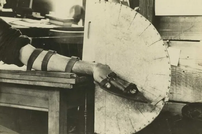Apparatus For Measuring Extension-Flexion Of The Wrist, Part Of Physical Rehabilitation, Circa 1914-1918