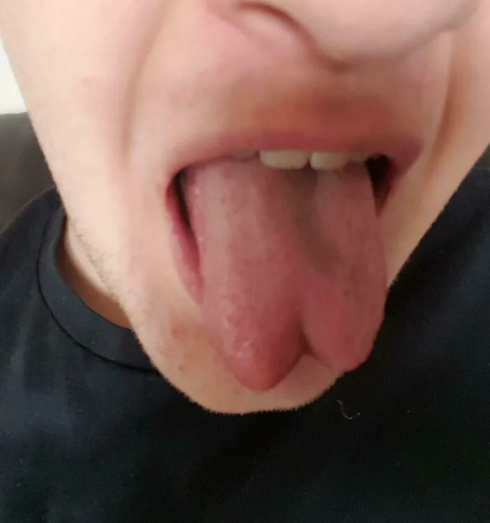 Mi lengua es naturalmente bífida