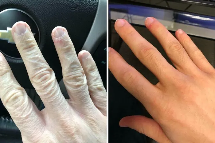Manos comparativas mostrando diferencias en piel y textura como rasgos distintivos del cuerpo humano visibles.