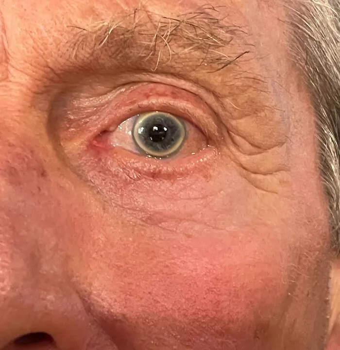 Ojo envejecido con arrugas y piel característica, mostrando rasgos distintivos del cuerpo humano que destacan.