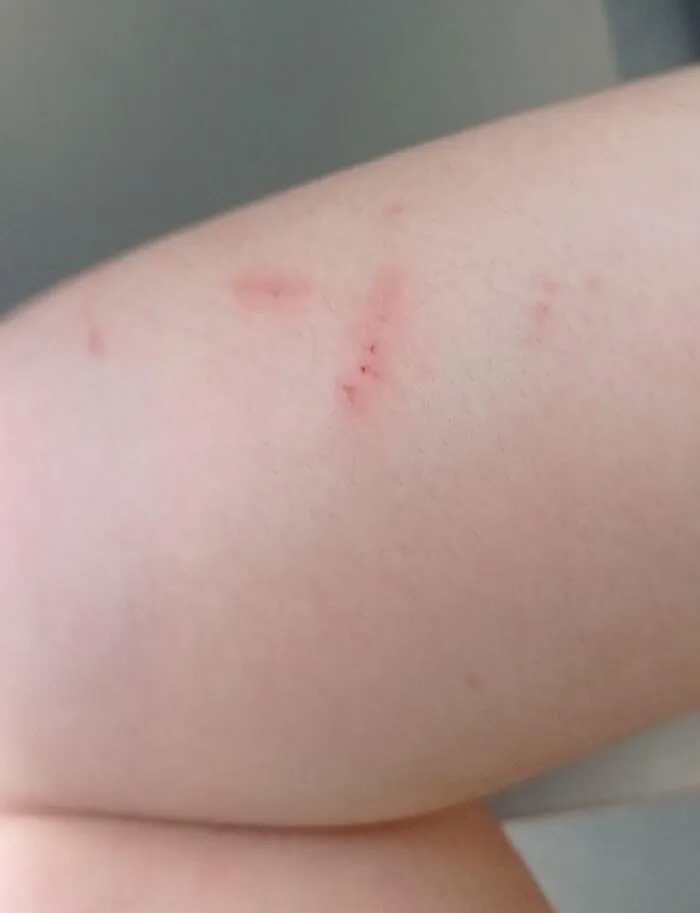 Mi hermana me hizo esto hoy después de gritar durante 15 segundos porque le pedí que dejara de cantar tan fuerte. Ella tiene 25 años. Yo tengo 15.