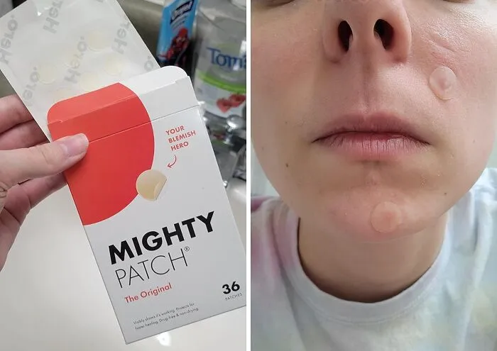 That Angry, Under-The-Skin Volcano That Has Decided To Take Up Residence On Your Chin Can Be Served A Cease-And-Desist Order Overnight With A <a Style="Display:inline;" Href="Https://Www.amazon.com/Mighty-Patch-Hydrocolloid-Absorbing-Count/Dp/B074pvtpbw?ie=utf8&th=1&linkcode=ll1&tag=bphawk-20&linkid=0a0cb763e01247524d7cd335fbacf621&language=en_us&ref_=as_li_ss_tl" Target="_blank">  <span Style="Font: Inherit; Color: #d74b1f;"> Mighty Patch Pimple Patch </Span>