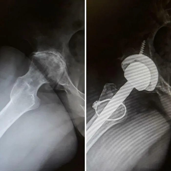 Radiografías comparativas que revelan la diversidad inesperada de la vida en anatomía ósea y prótesis médicas.