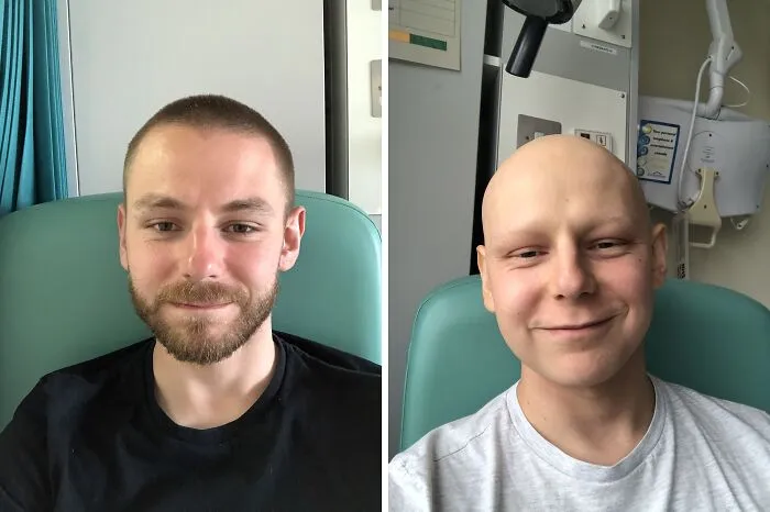 The Difference Three Months Of Hardcore Chemotherapy Makes