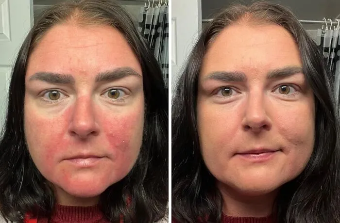 When Your Face Is Basically Broadcasting All The Bad Decisions You Made Last Night, A Layer Of <a Style="Display:inline;" Href="Https://Www.amazon.com/Lor%c3%a9al-Paris-Beautifier-Moisturizer-Anti-Redness/Dp/B00l2snfpq?ie=utf8&th=1&linkcode=ll1&tag=bpsnail-20&linkid=a598dd6787eccc9251a890be3e889d39&language=en_us&ref_=as_li_ss_tl" Target="_blank"> <span Style="Font: Inherit; Color: #d74b1f;"> L'oréal Bb Cream </Span> Is How You Switch To A Private Channel