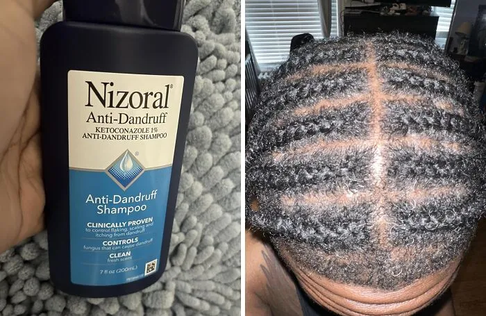Nizoral Anti-Dandruff Shampoo With 1% Ketoconazole, Fresh Scent, 7 Fl Oz