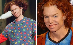 20 Before-And-After Pictures Of Celebs Who Went Too Far With Plastic Surgery 