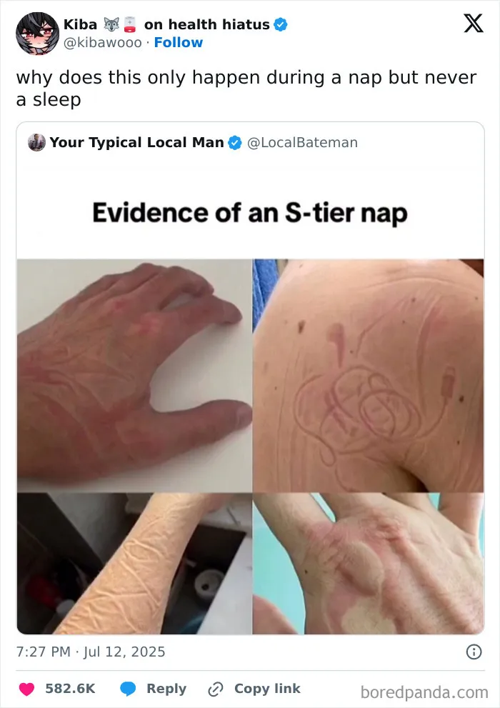 Humorous meme showing skin marks from an S-tier nap, featured in popular memes to break your doomscrolling cycle.