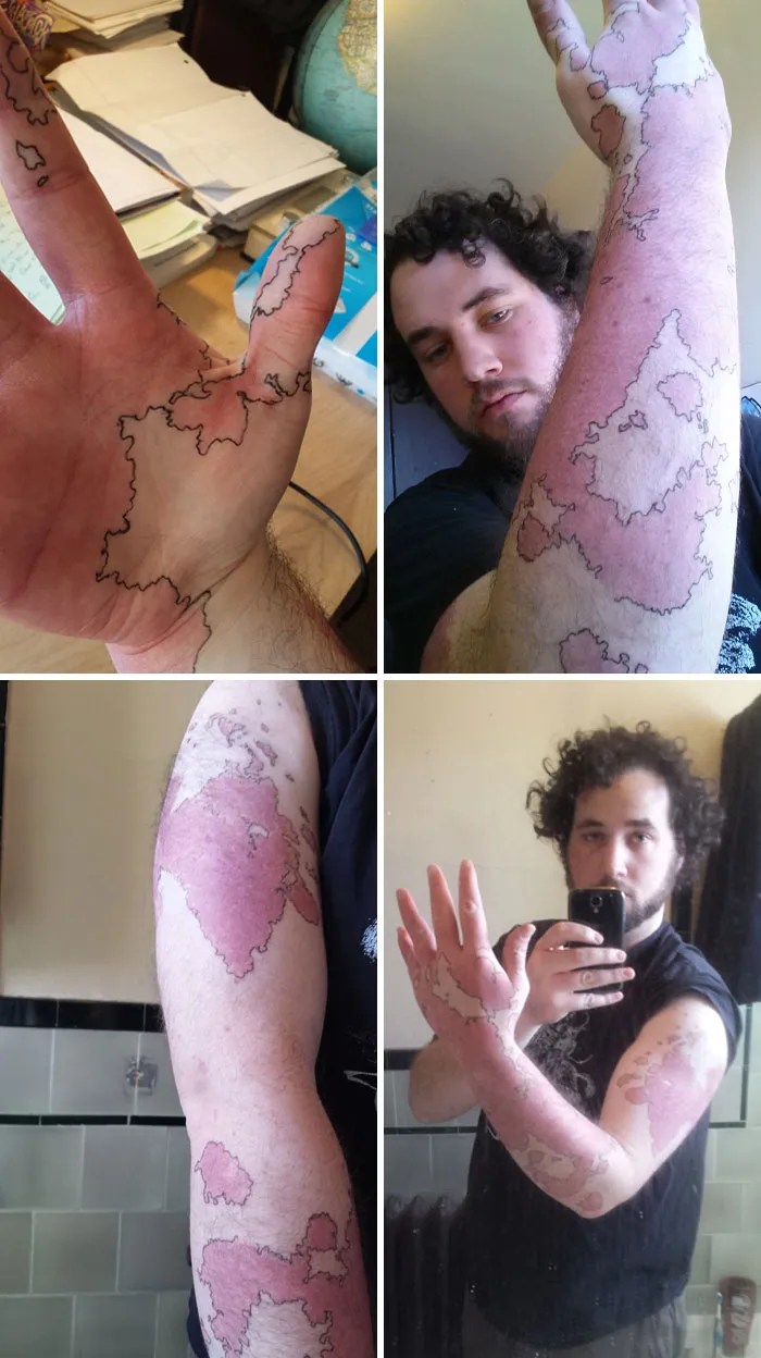 I Was Born With A Map Of Places That Do Not Exist Upon My Arm And Hand. Outlined With Pen For Your Convenience