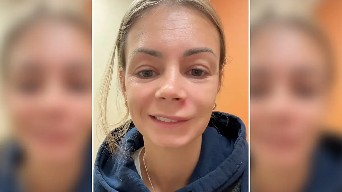 Mom Ends Up in Urgent Care After Popping Pimple In The “Triangle Of Death”