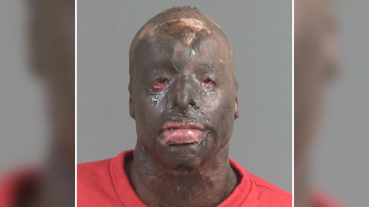 17-Year-Old Fatally Shot, Main Suspect Turns Himself In But His Appearance Stuns People