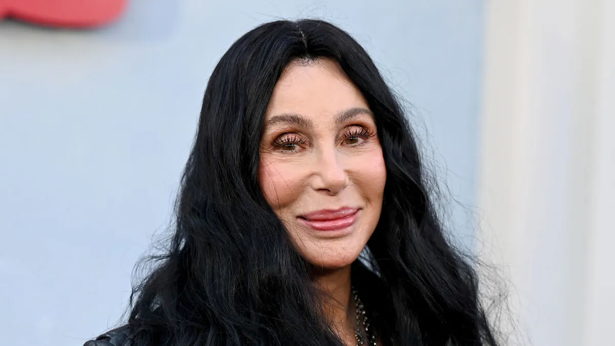 Cher's 'Melting' Appearance Sparks Concern As Her Friends Break Silence On Her Plastic Surgery 'Indulgence'
