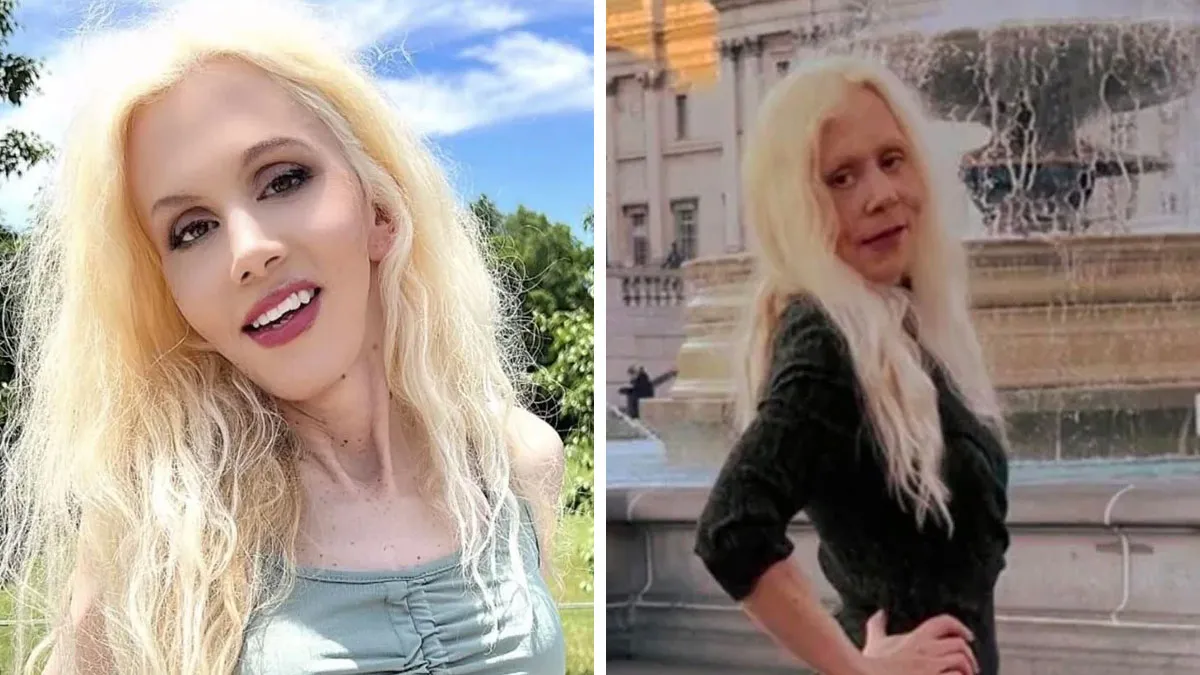 Filters, Facades, And Full-Blown Delusion: 40 Times Instagram Collapsed Under Reality (New Pics)