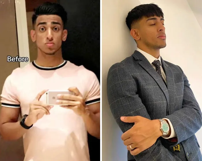 Before and after photos showing a stylish glow-up effect, highlighting confidence and improved appearance.