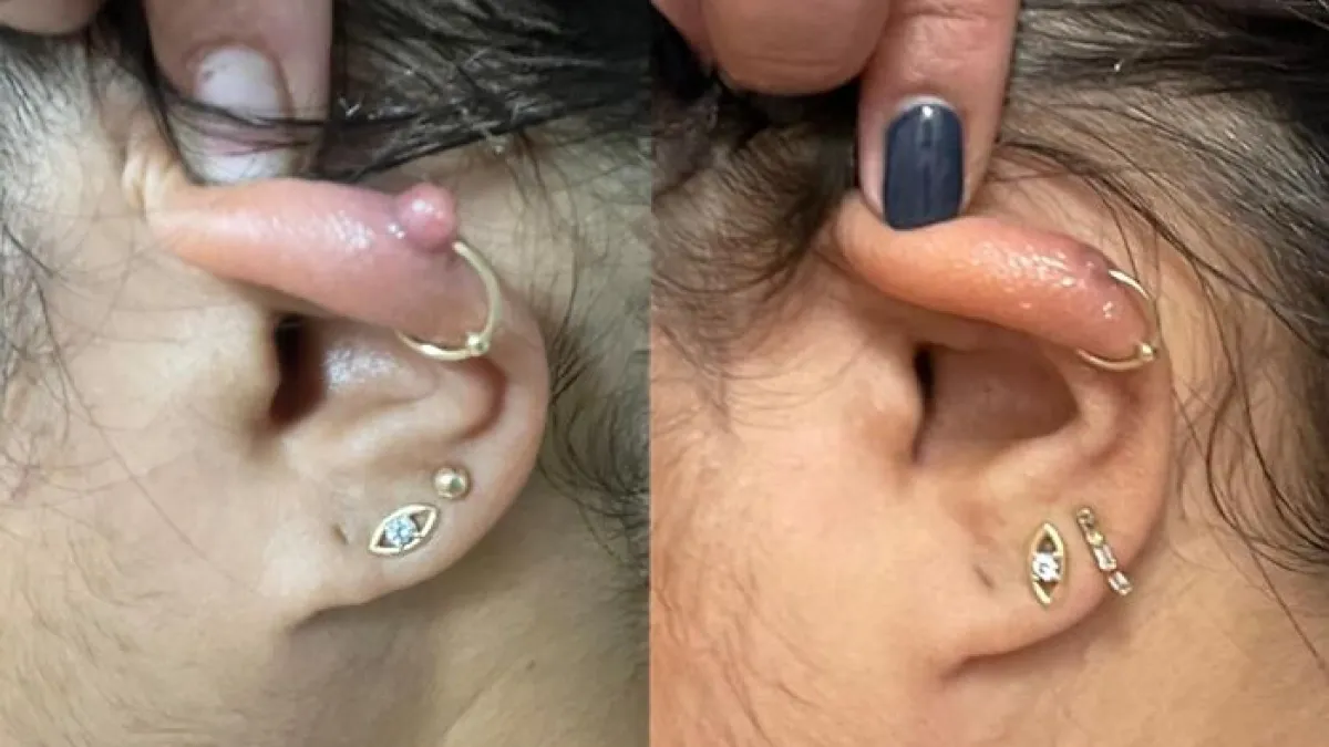 19 Gross-But-Genius Products That People Actually Swear By For Their Body Issues 